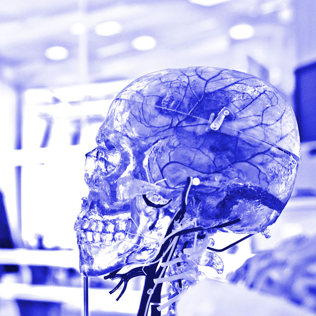 AI is Upon Us: What Does This Mean for Businesses?